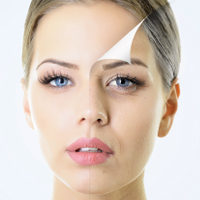 Ask the Beauty Expert: Making Sense of Medical Esthetic Treatments